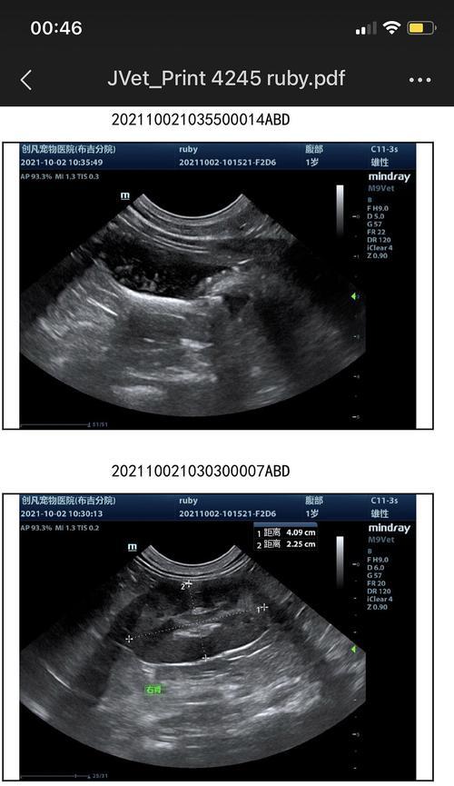 膀胱结晶的成因与症状解析，掌握预防与治疗方法