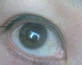 揭秘眼白混浊的原因（探寻眼白混浊形成的根源和解决方法）