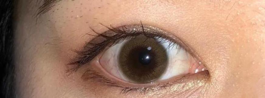 揭秘眼白混浊的原因（探寻眼白混浊形成的根源和解决方法）