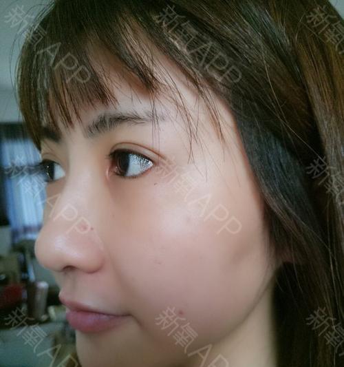 怀孕初期常见症状解析与科学应对指南，助力孕期健康