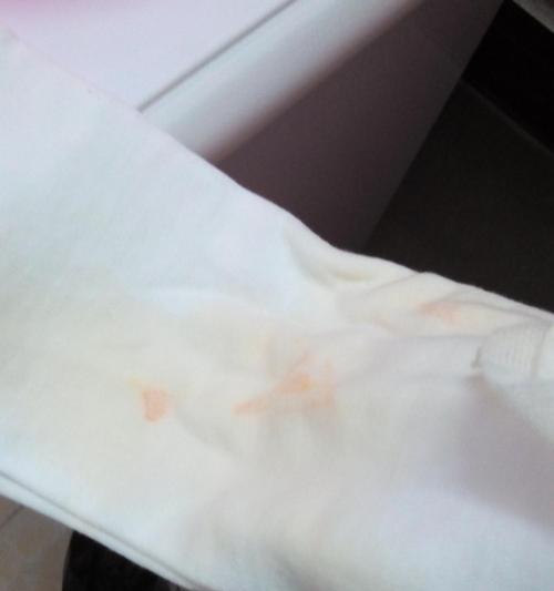 尿中出现血迹，你需要了解的原因和应对方法