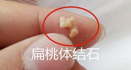 身上异味或预示疾病？解析体臭背后的健康隐患与应对方法