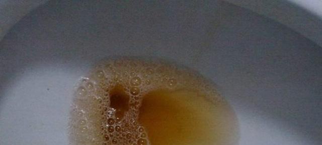 身上气味臭可能是什么病？（探索身体气味异常的潜在疾病及其治疗方法）