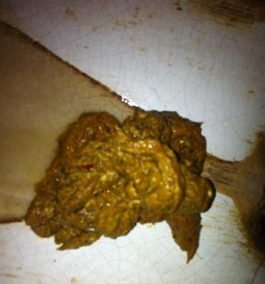 拉大便不成形的原因及处理方法（探讨拉大便不成形的病因和预防措施）