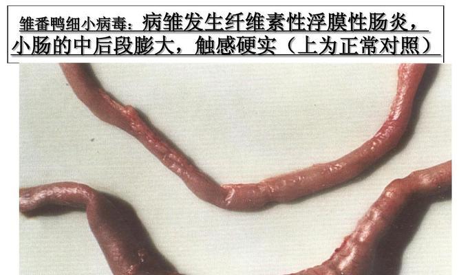 慢性细小症状全面解析（了解慢性细小症状及其治疗关键）