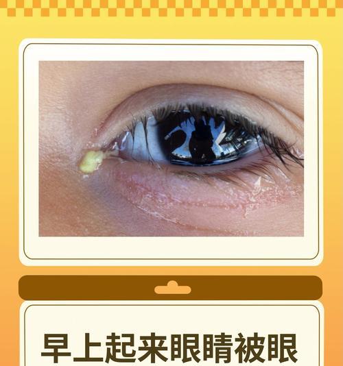 狗眼睛眼屎多的原因及药物治疗方案（揭秘狗眼屎多的真相，告别犬类眼部问题）