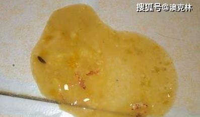 狗罐装病毒（了解病毒传播途径和常见症状，提高防控意识）