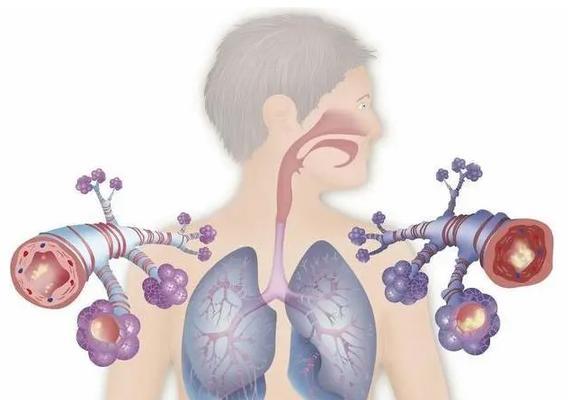 比熊气管炎症状与治疗全解析，守护狗狗健康呼吸