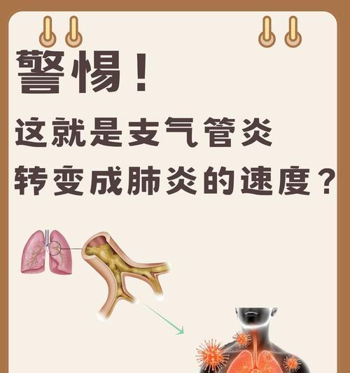 多菌康喷剂治疗周期与效果详解