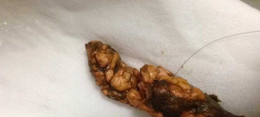 细小第五天饮食指南｜康复饮食实用建议