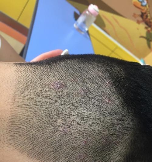 狗狗为何会有头皮屑(头皮屑问题的成因及解决方法) 狗狗为何会有头皮屑(头皮屑问题的成因及解决方法)