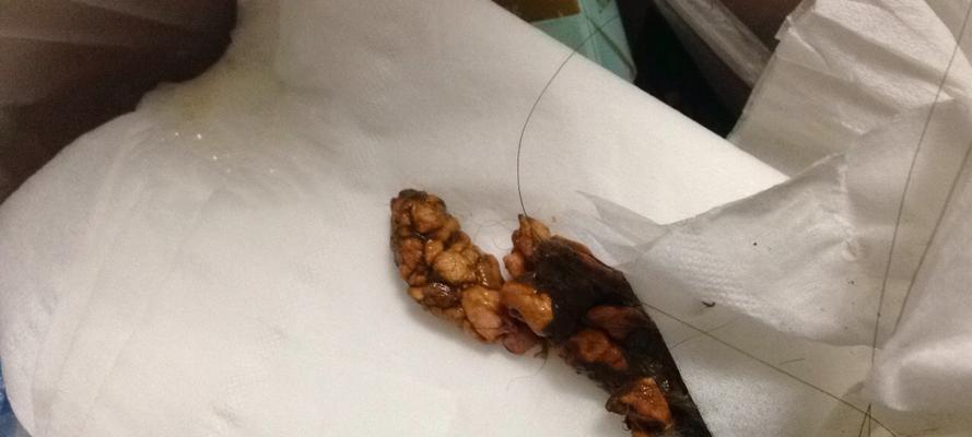 细小早期拉什么便便｜实用指南助你识别症状