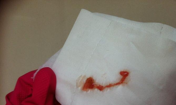 揭秘宠物泰迪的大便之谜（了解泰迪的消化系统，从大便说起）