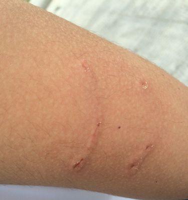 雪纳瑞狗狗狂犬疫苗接种时间解析（了解雪纳瑞狗狗的疫苗接种计划，守护它的健康）