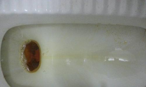 尿液变绿色的原因及其健康含义（探究尿液发绿的可能原因，了解身体健康情况）