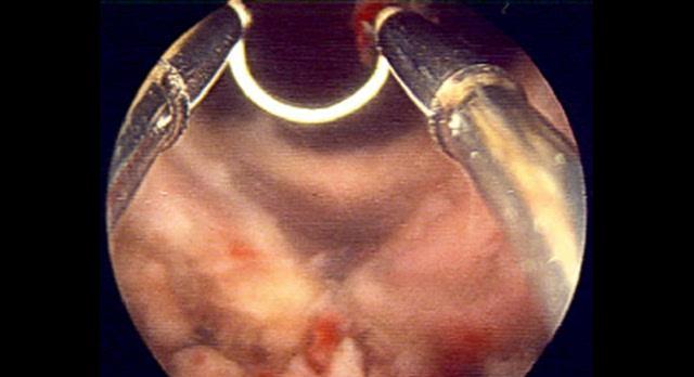 尿液变绿色的原因及其健康含义（探究尿液发绿的可能原因，了解身体健康情况）