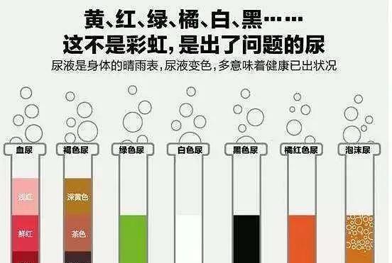 尿液变绿色的原因及健康含义｜实用指南