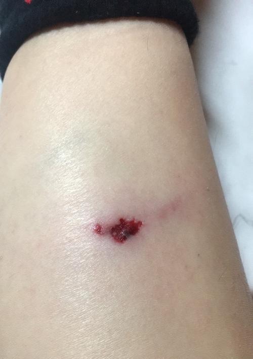 狗狗被咬伤皮肤问题处理指南｜家庭应急护理全攻略