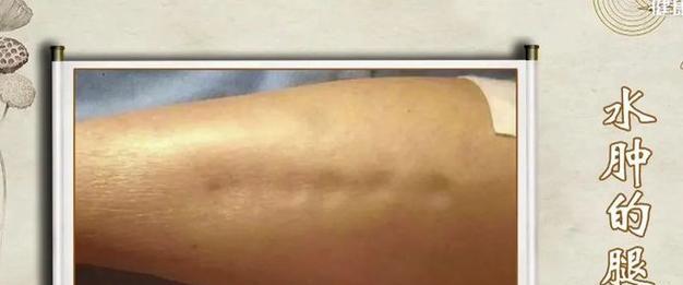 老年犬心衰的症状及其管理方法(老年犬心衰的常见症状及应对措施) 老年犬心衰的症状及其管理方法(老年犬心衰的常见症状及应对措施)