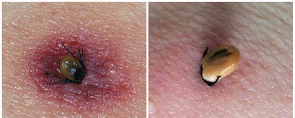 狗狗被蜱虫咬后的危害全攻略