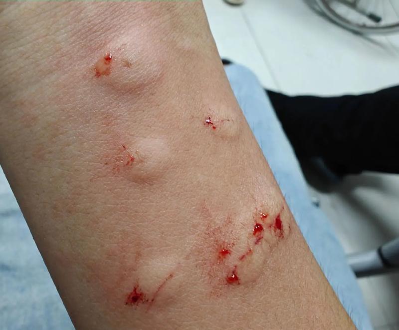 狗缺白蛋白的症状及预防措施（了解狗缺白蛋白症状的重要性，以及如何预防）