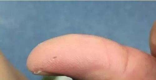 荷兰猪咬人的原因及如何预防（了解荷兰猪攻击的原因，确保与宠物的安全）