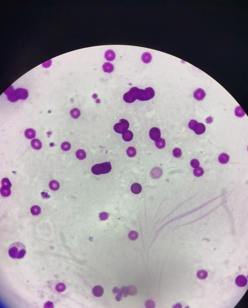 以犬焦虫——狗狗健康的威胁（以犬焦虫的症状及预防措施）