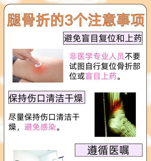 大腿骨折康复时间有多久？（恢复期、康复措施及预防）