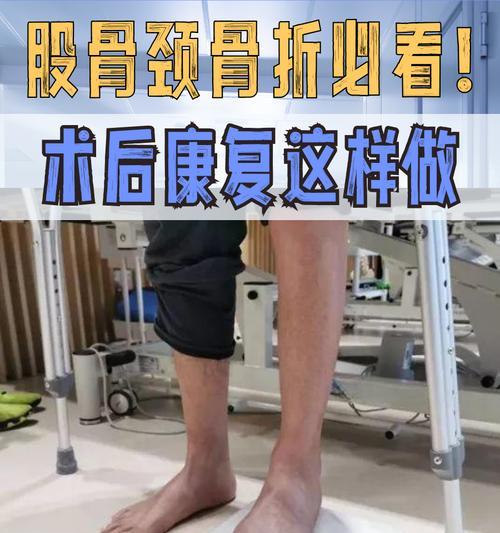 大腿骨折康复时间有多久？（恢复期、康复措施及预防）
