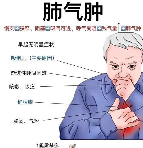 狗狗肺气肿常见表现及处理方法全攻略