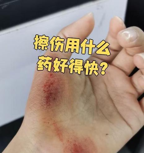 皮肤擦伤发炎应对指南（急救小知识，有效防范皮肤擦伤后的感染风险）